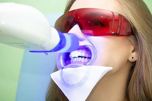 Laser teeth whitening treatments Nottinghamshire