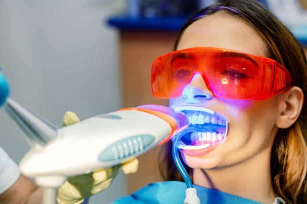 Simplifying Teeth Whitening: A Comprehensive Guide Nottinghamshire