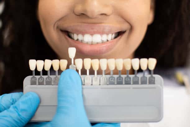 Laser Teeth Whitening: Exploring the Longevity of Your Brighter Smile Nottinghamshire