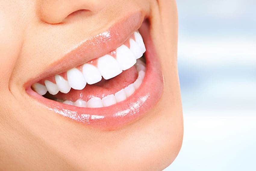 Teeth Whitening Abingdon Nottinghamshire