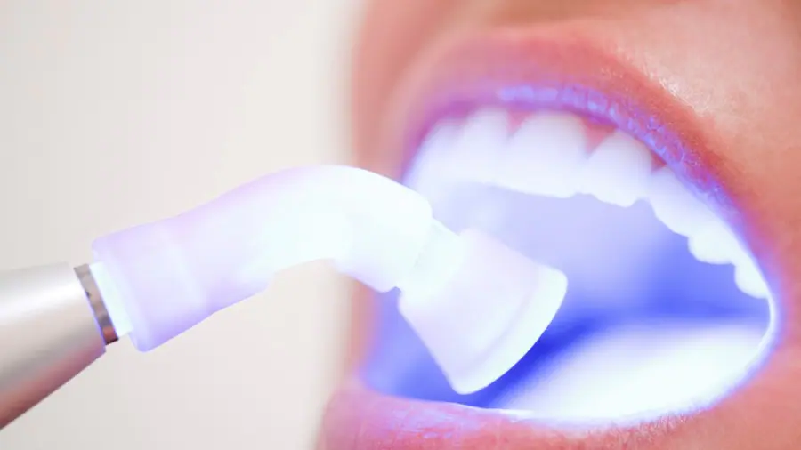 Teeth Whitening Aylesbury Nottinghamshire